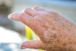 Taches Blanches Et Brunes Comment Les Atténuer